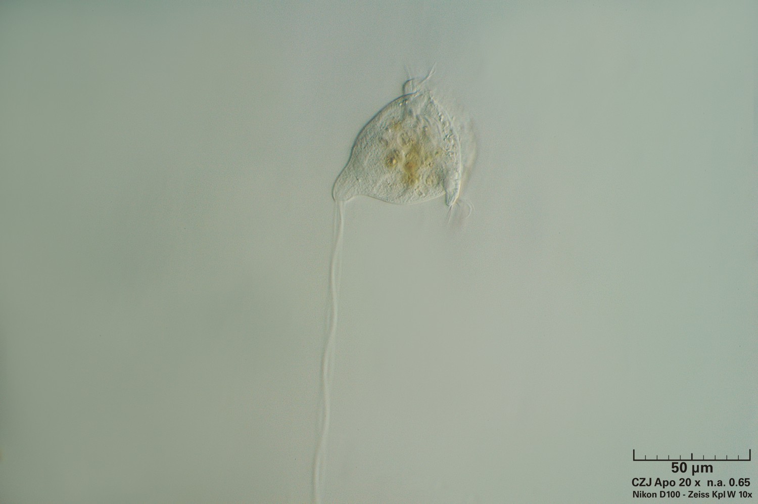 Vorticella n.2